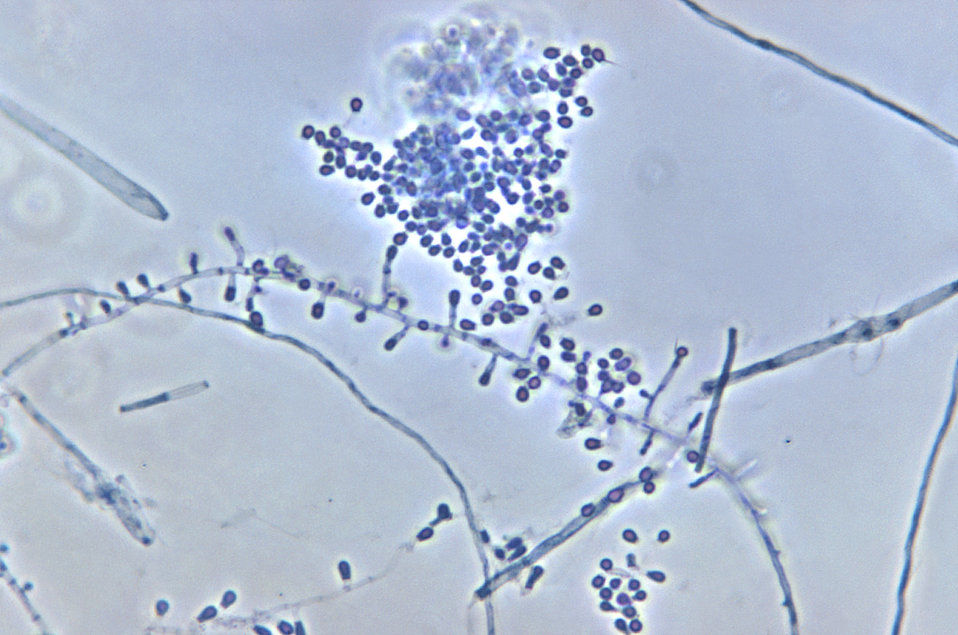 Public Domain Picture | Magnified 500X, this photomicrograph revealed ...