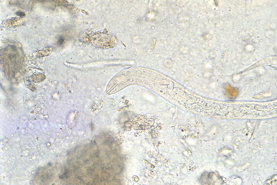 Under a relatively high magnification of 400X, this photomicrograph revealed some of the morphologic ultrastructure of a hookworm rhabditifo
