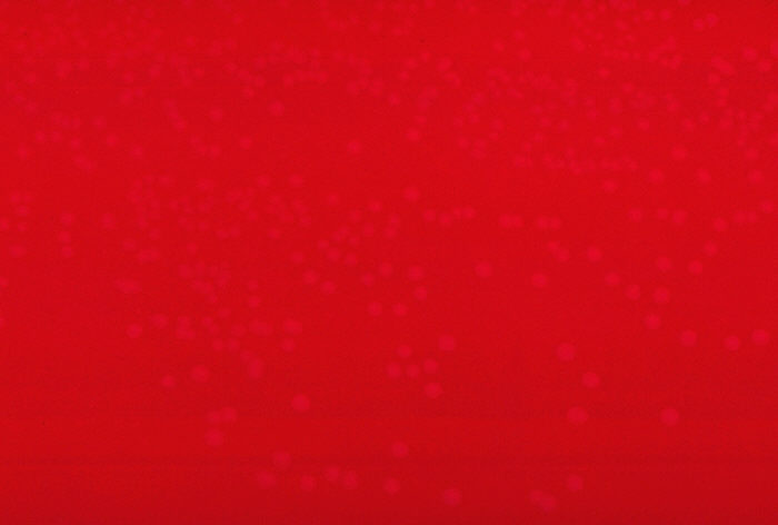 Blood agar plate culture of Erysipelothrix rhusiopathiae.