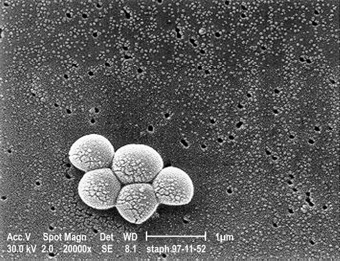 Magnified 20,000X, this scanning electron micrograph depicts a grouping of methicillin resistant Staphylococcus aureus (MRSA) bacteria.  See