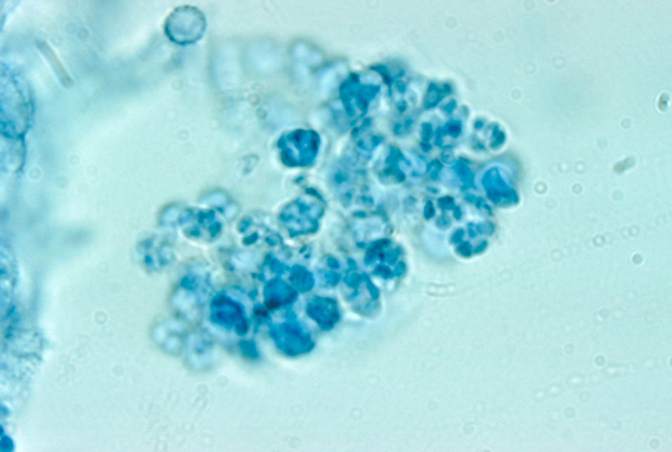 This photomicrograph shows the asci and ascospores of the fungus Arthroderma grubyi, formerly Nannizzia grubyia.