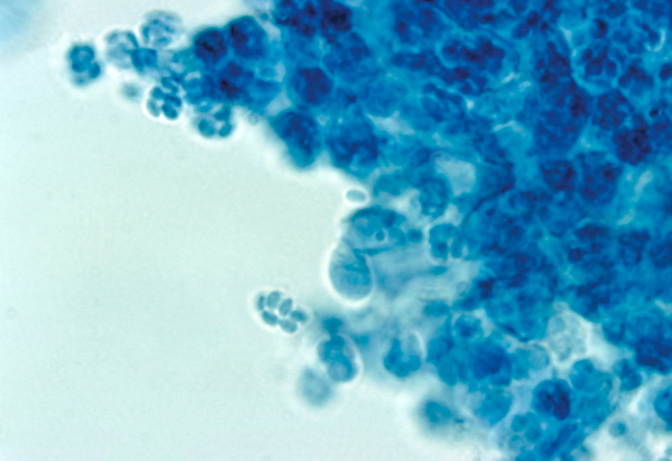 This photomicrograph shows the asci and ascospores of the fungus Arthroderma grubyi, formerly Nannizzia grubyia.