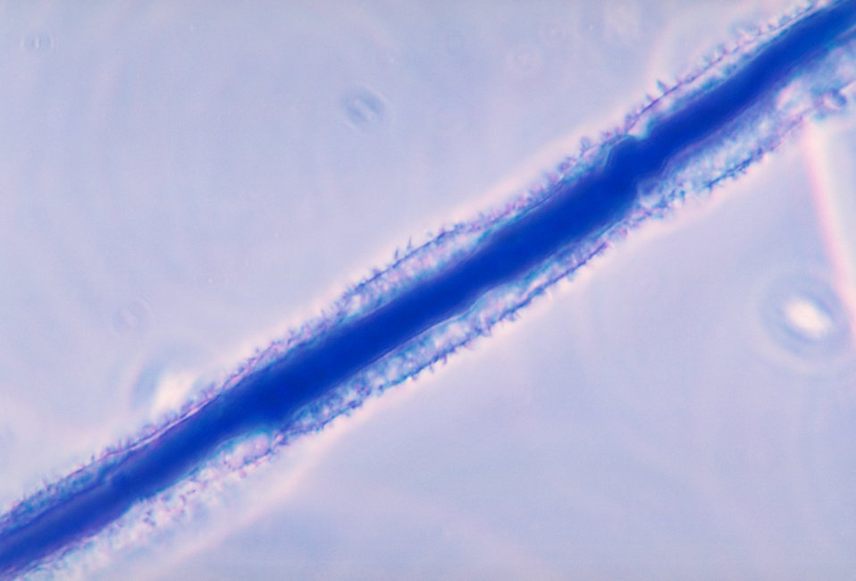 This photomicrograph depicts the appearance of a 'rough' conidiophore of the fungus Aspergillus flavus.