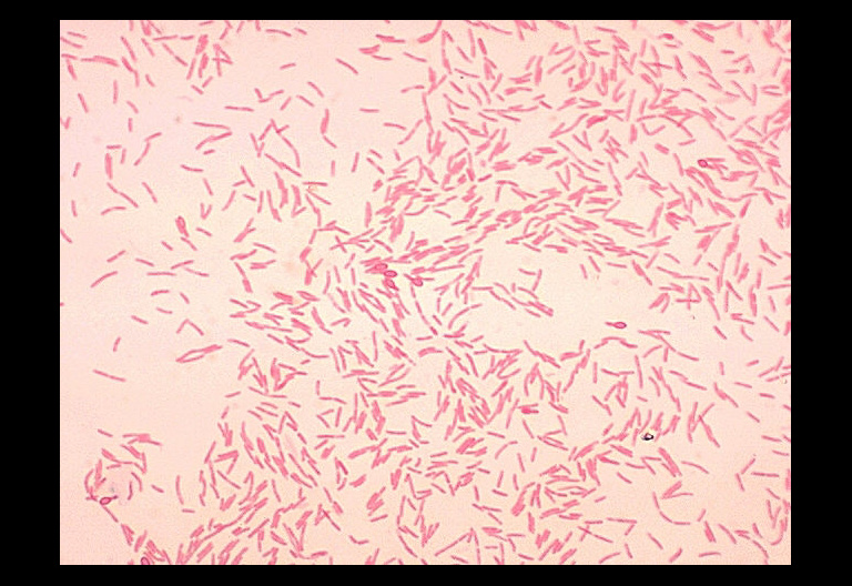 Bacillus circulans showing spores.  Gram stain.
