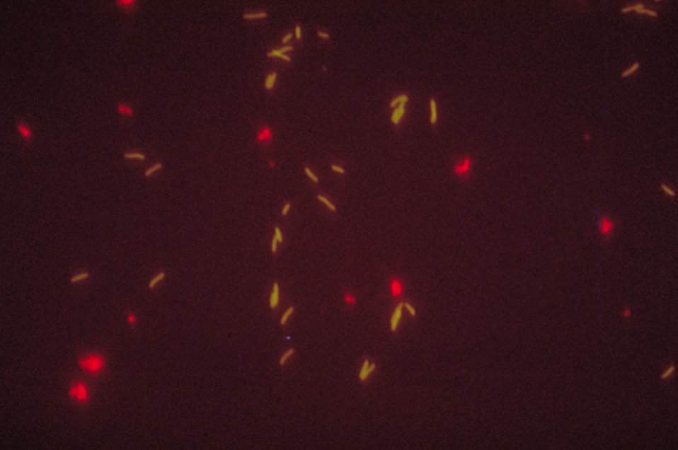 Photomicrograph of Legionella pneumophila using indirect FA staining technique, and fluorescein antihuman label.