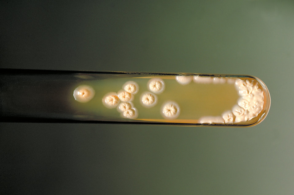 This is a SABHI agar slant culture of the fungus Sporothrix schenckii at 37�C.