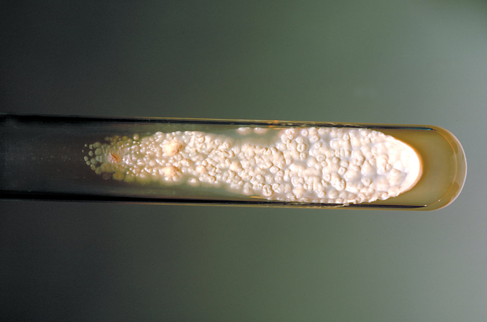 This is a SABHI agar slant culture of the fungus Sporothrix schenckii at 37�C.