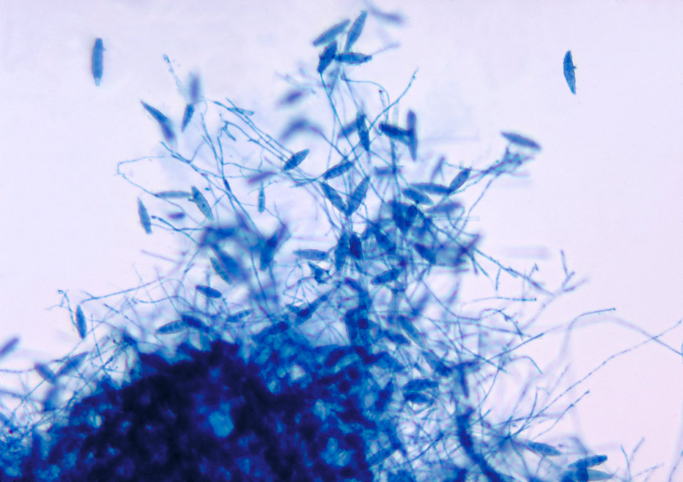 This is a photomicrograph of the fungus Microsporum gypseum using the lactophenol cotton blue staining technique.