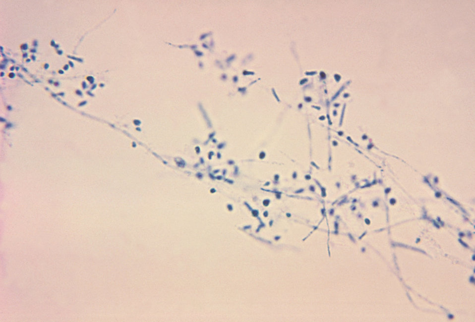 This is a photomicrograph of the fungus Microsporum gypseum using the lactophenol cotton blue staining technique.