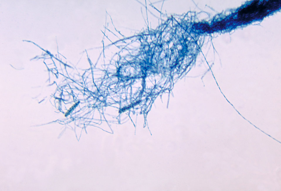 This is a photomicrograph of the fungus Microsporum cookei using the lactophenol cotton blue staining technique.