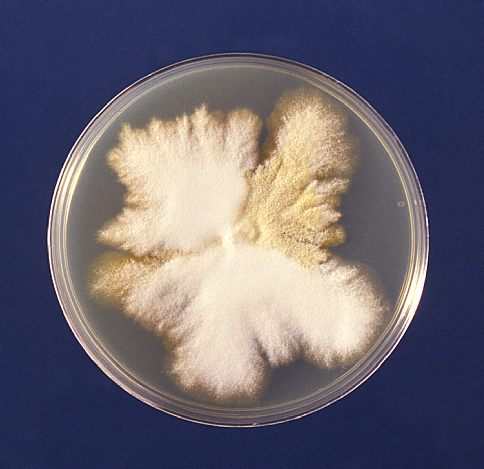 This image is a plate culture of the fungus Trichophyton mariatii.