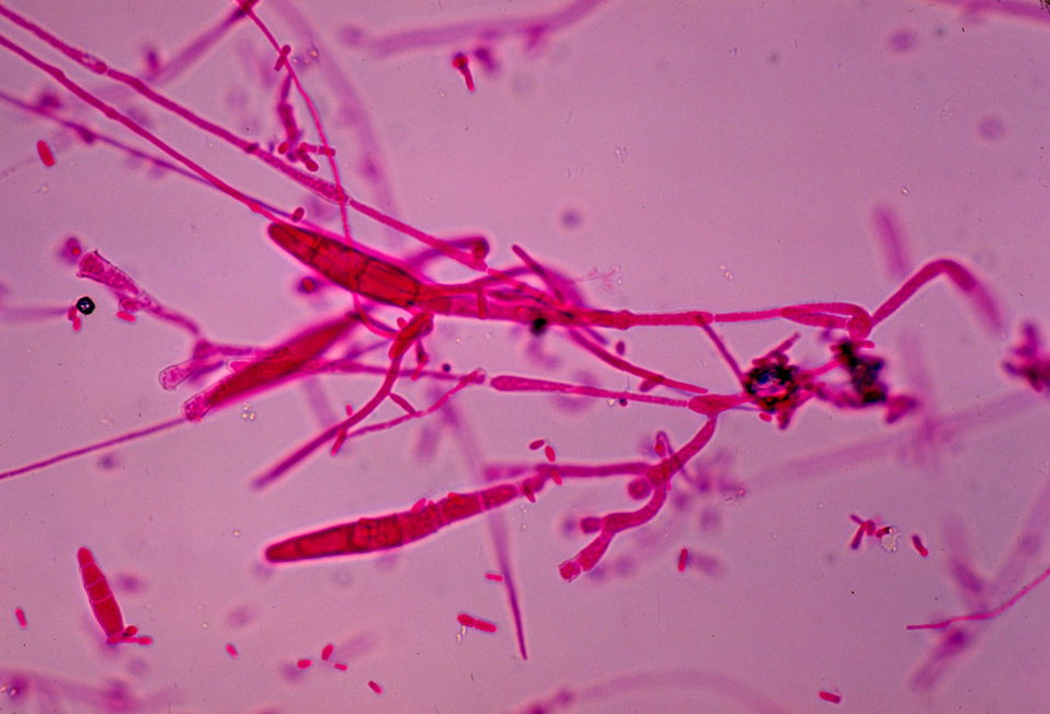 This photomicrograph depicts the microconidia of the fungus Trichophyton mariatii.