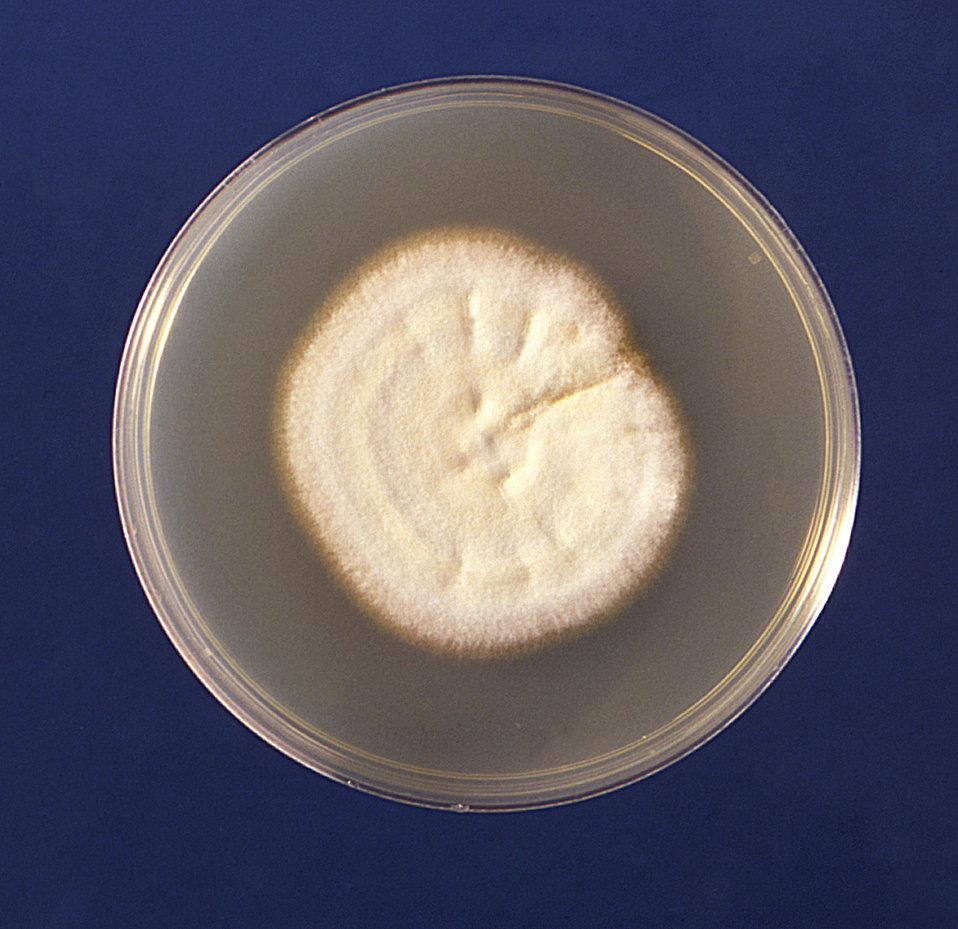 This image depicts the colonial growth on a plate culture of the fungus Trichophyton mariatii.