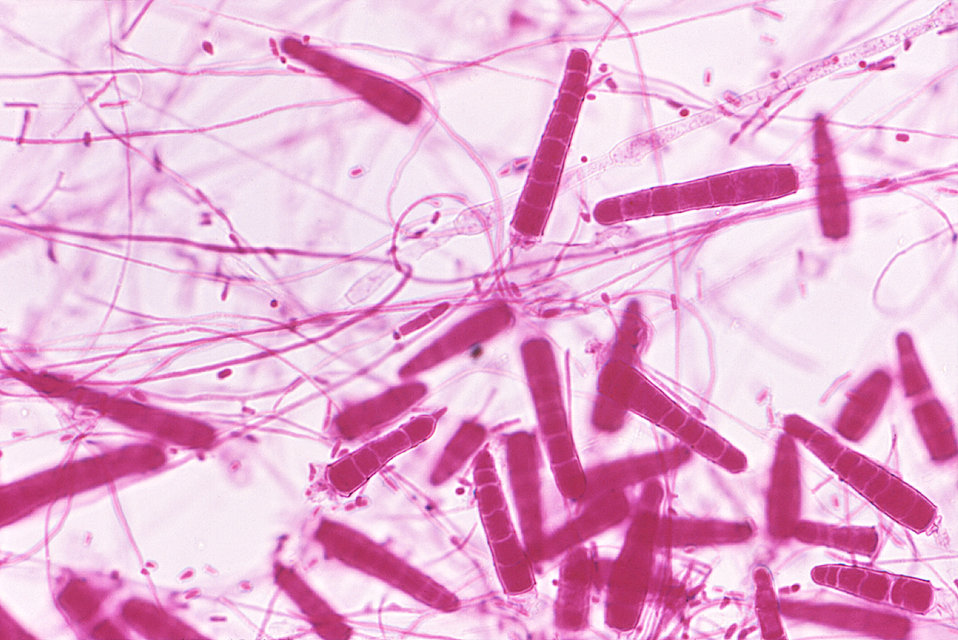 This photomicrograph depicts the microconidia of the fungus Trichophyton mariatii.