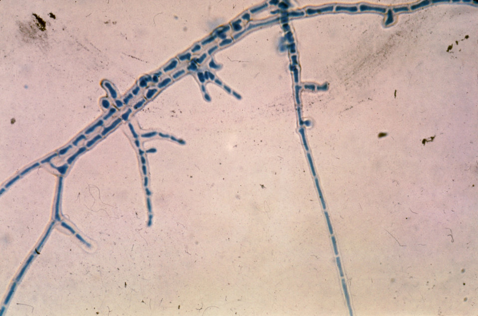 This is a photomicrograph of the mycelium of the fungus Piedraia hortae, magnified 475X.