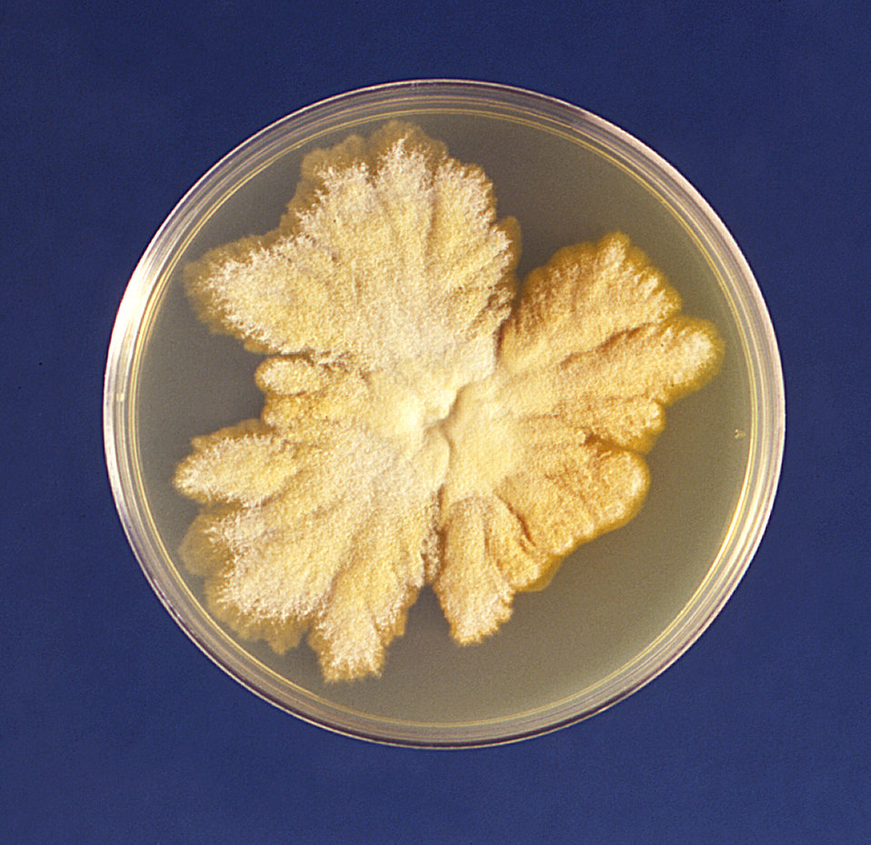 This is a plate culture of growing colonies of the fungus Trichophyton mariatii.