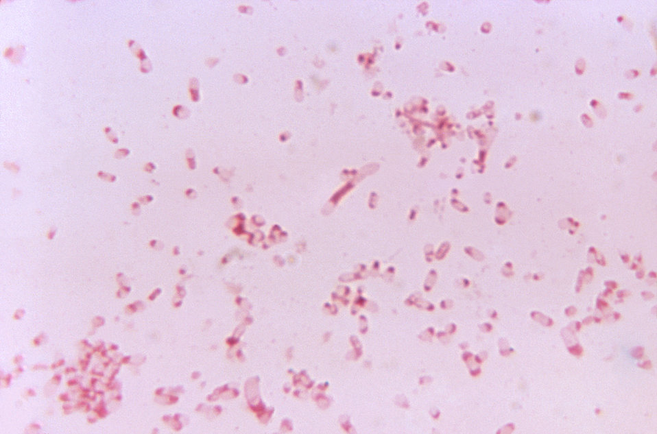 This photomicrograph shows the bacterium Bacteroides fragilis subsp. thetaiotaomicron cultured in a thioglycollate medium for 48 hours.