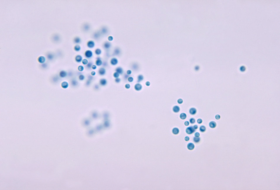 This photomicrograph depicts the encapsulated yeast Cryptococcus neoformans.