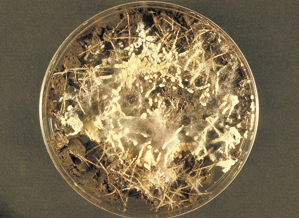 This image shows a soil hair plate culture growing the fungus Microsporum gypseum.