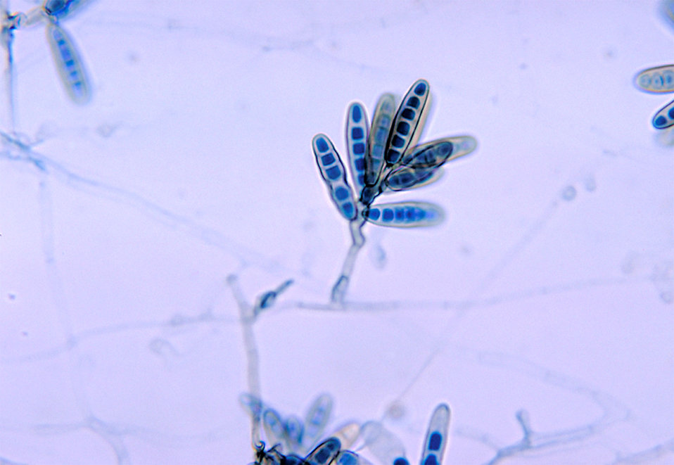 This micrograph reveals a conidia-laden conidiophore of the fungus Bipolaris hawaiiensis.