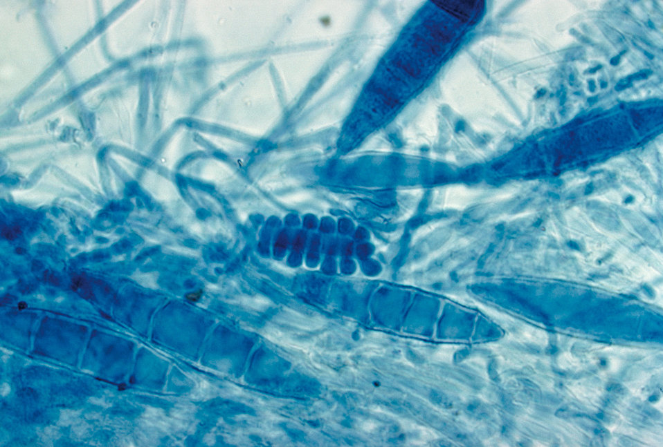 This image shows a cleistothecium of the fungus Arthroderma incurvatum .