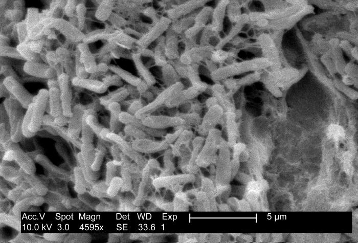 This micrograph depicts Gram-positive C. difficile bacteria from a stool sample culture obtained using a .1�m filter.