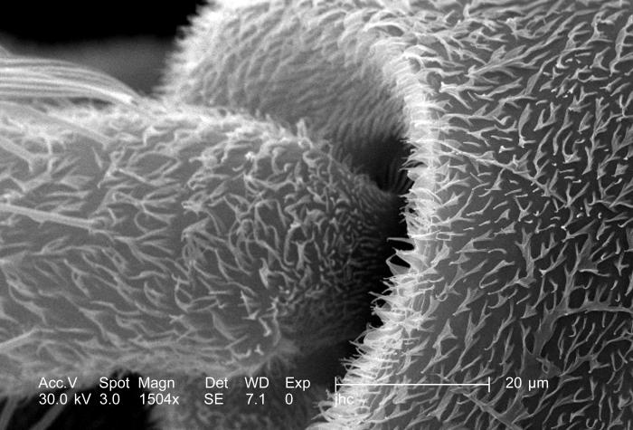 At a magnification of 1504x, approximately four times greater than PHIL 8789,  this scanning electron micrograph (SEM) revealed some of the 
