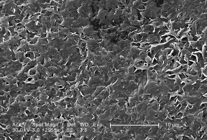 This scanning electron micrograph (SEM) shows the magnified rough surface of a Vitis sp., white table grape; Magnified  2955x. Note that wha