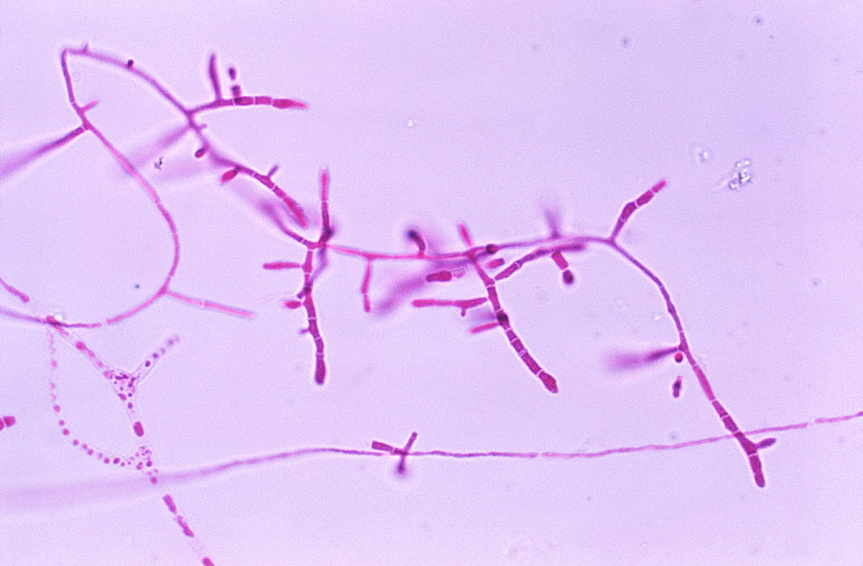 Magnified under a low magnification of 40X, this photomicrograph depicts the microconidia of the fungus Trichophyton mariatii.