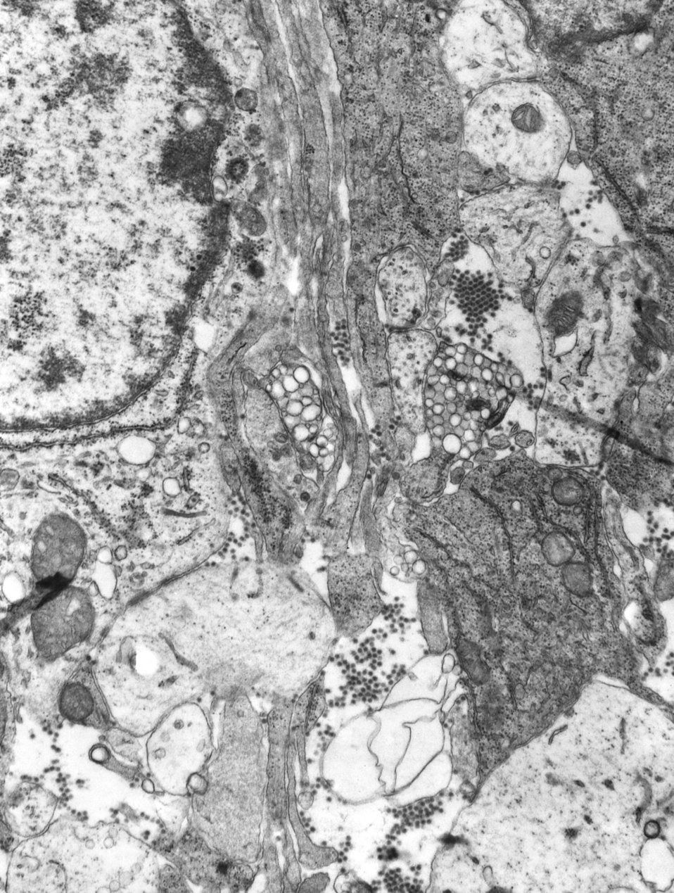 This 1975 transmission electron micrograph (TEM) revealed the presence of a number of Eastern Equine Encephalitis (EEE) virus virions in thi