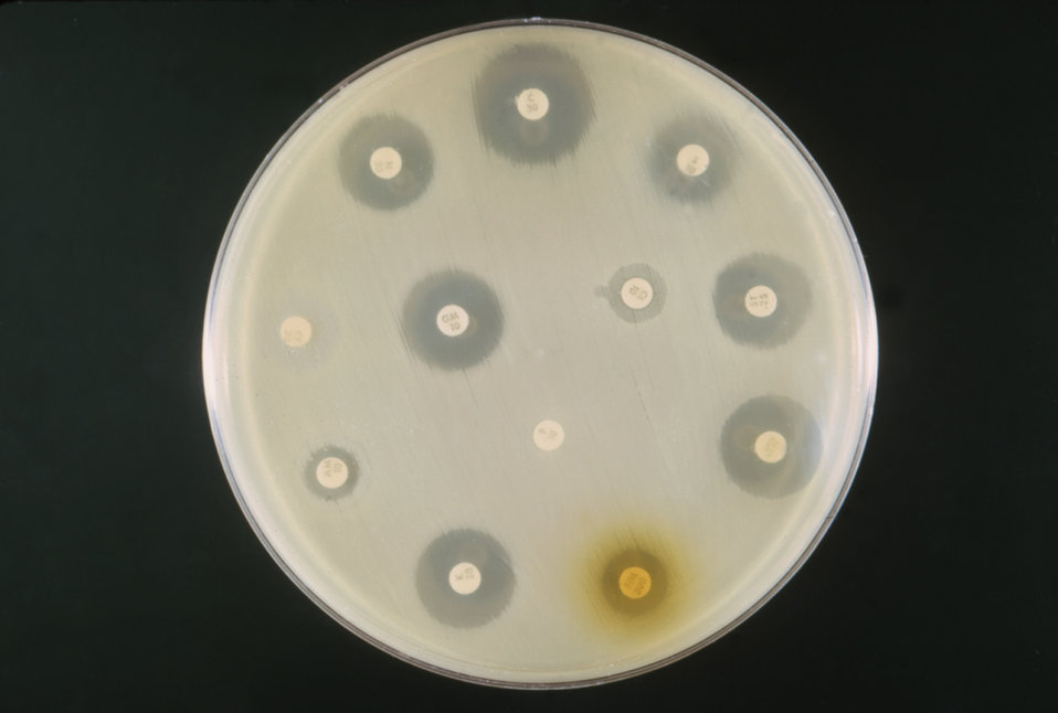 This is an example of an antibiotic sensitivity test on a mixed culture of E. coli and a Proteus sp., at a pH 7.2.