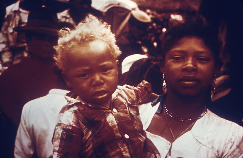 Note the depigmentation of this child's hair who is suffering from kwashiorkor due to malnutrition, 1970.