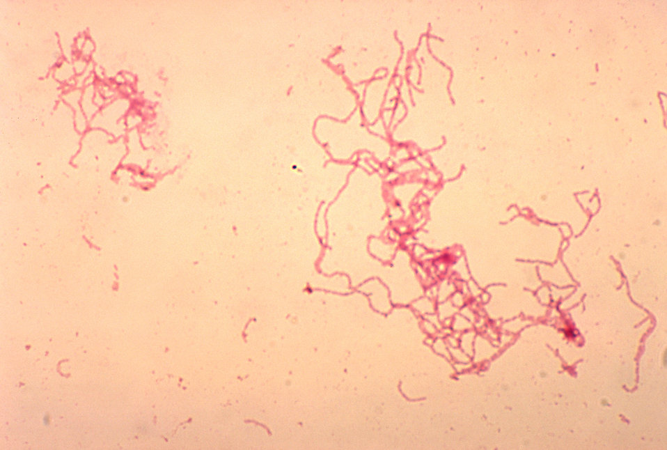 A rabbit blood culture photomicrograph of Haemophilus ducreyi bacteria using Gram-stain technique.