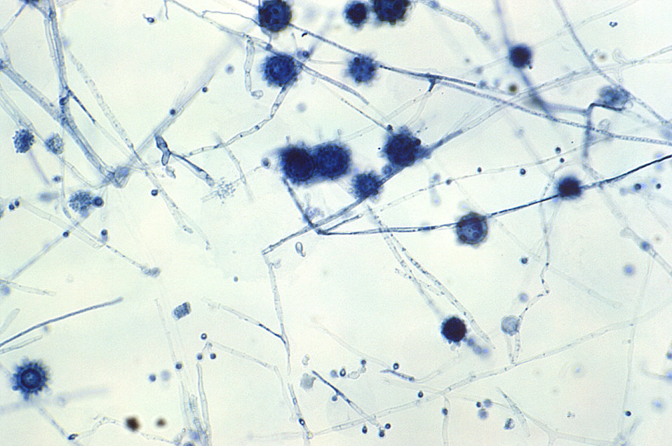 At a magnification of 400X, this photomicrograph revealed some of the ultrastructural morphology exhibited by Histoplasma capsulatum fungal 