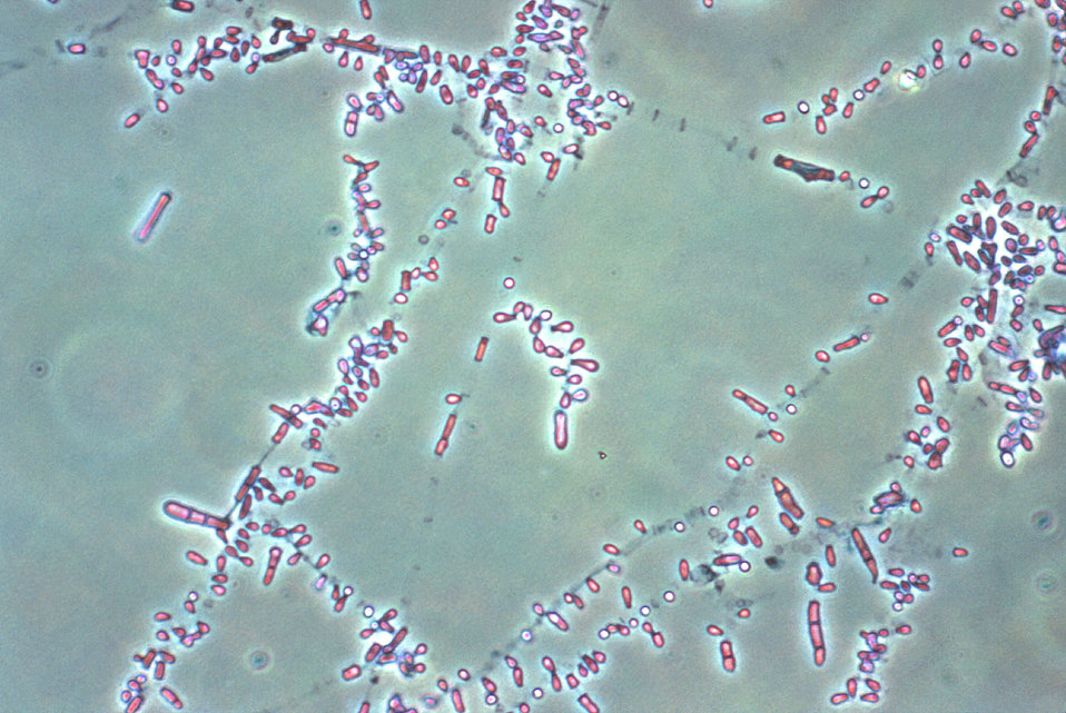 This photomicrograph revealed some of the ultrastructural morphology exhibited by Trichophyton rubrum fungal organisms.