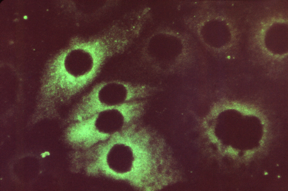 Stained using a fluorescent antibody (FA) technique, this photomicrograph revealed a positive result for this stained serum specimen from a 