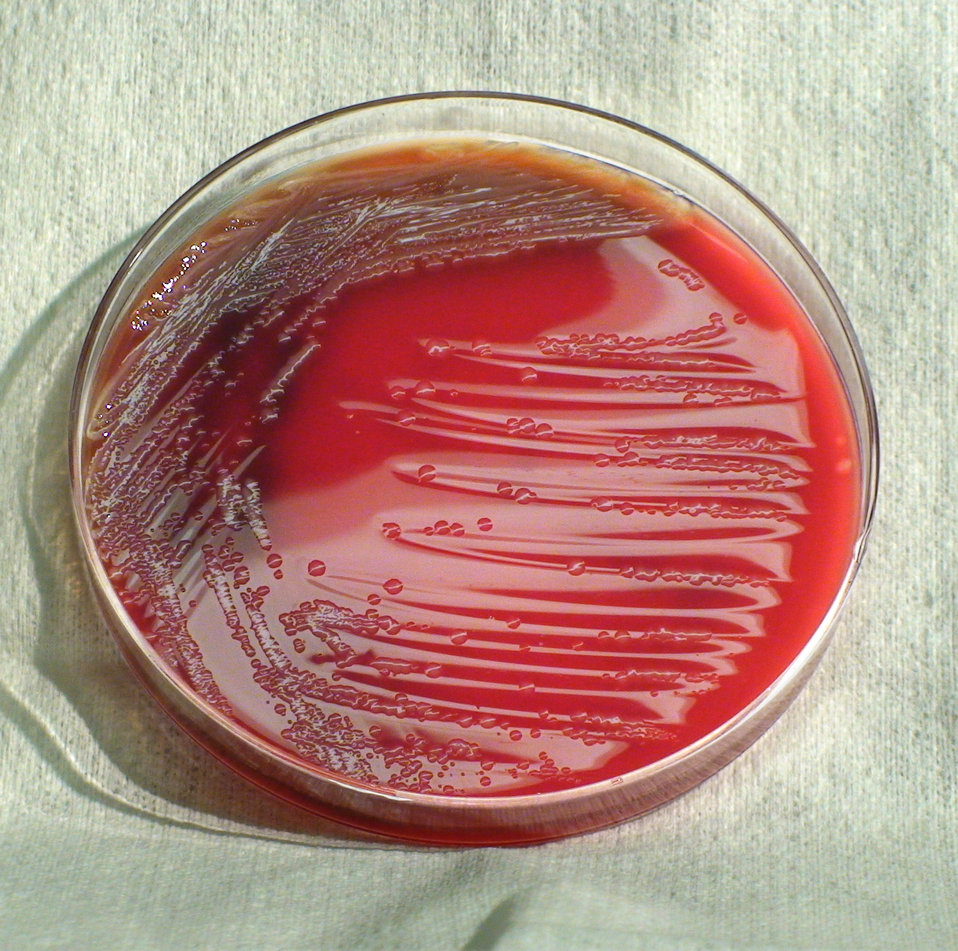 This photograph depicts the colonial morphology displayed by Gram-negative Morganella morganii bacteria, which was grown on a medium of shee